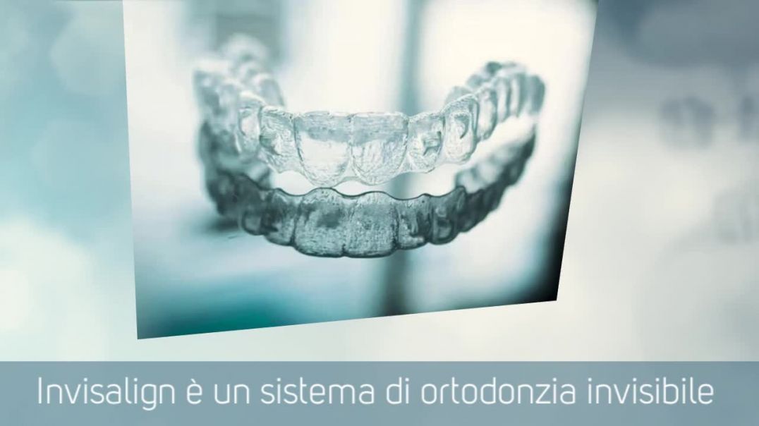 Ortodonzia Invisibile Roma