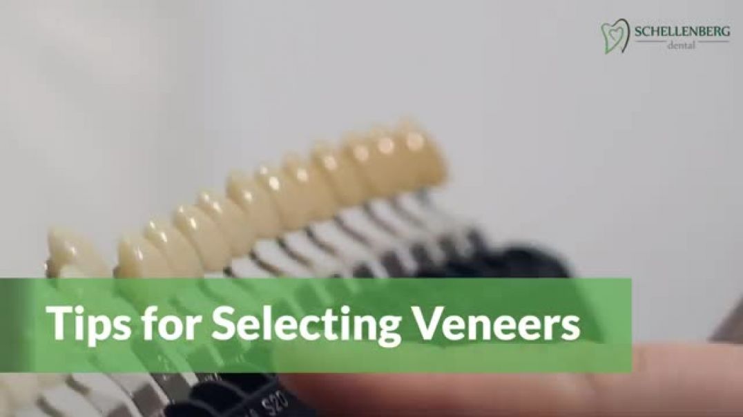 An Expert's Guide to Selecting the Ideal Veneers