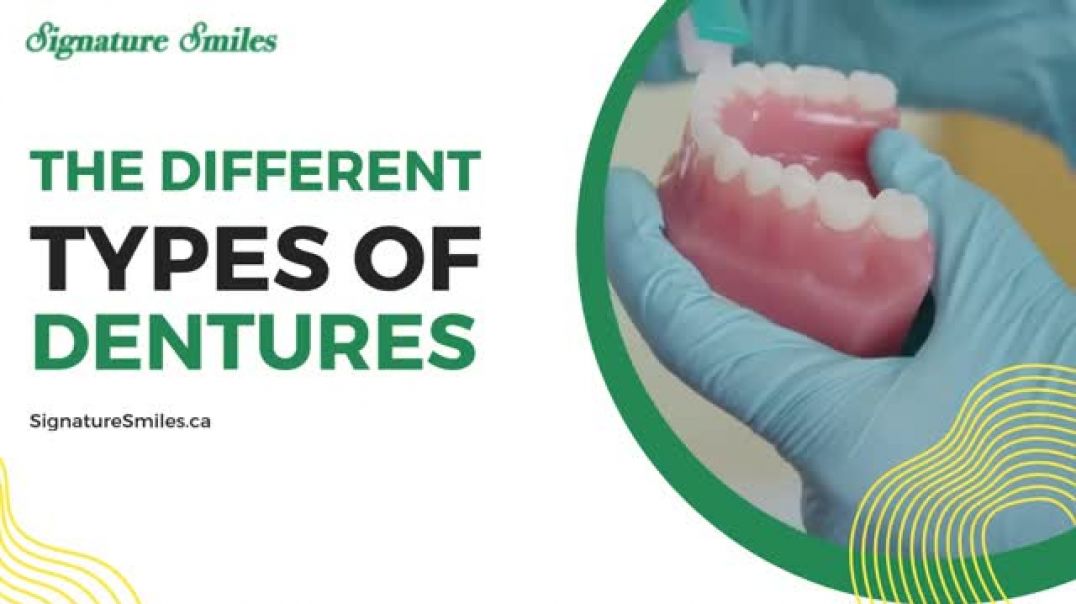 Comprehensive Guide: The Different Types of Dentures