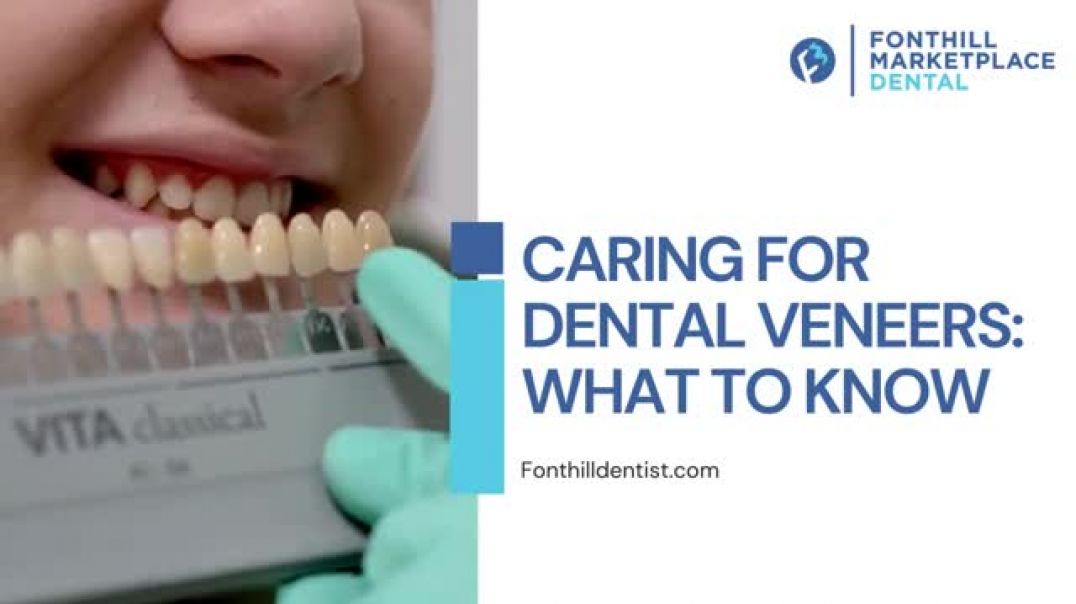 Tips and Tricks for Maintaining Your Dental Veneers