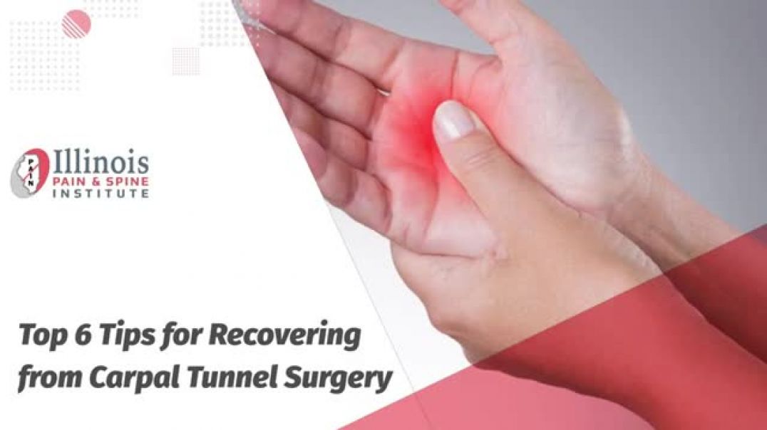 Carpal Tunnel Surgery Recovery: 6 Tips You Need to Know