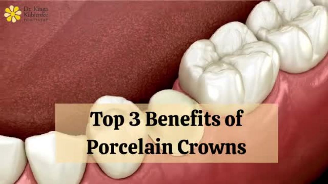 Enhance Your Smile with Expert Porcelain Crowns in Toronto