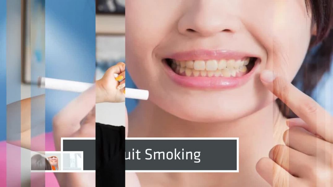 Professional Teeth Whitening Treatment